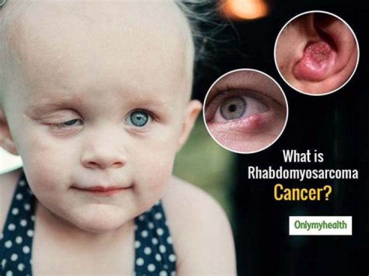 
Who Is Megan Bugg? 7-Year-Old Alveolar Rhabdomyosarcoma Cancer Fighter Dies 